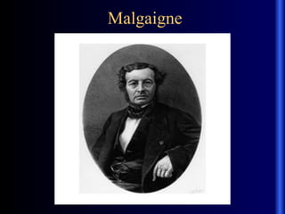 Malgaigne
 