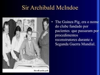 Sir Archibald McIndoe
• The Guinea Pig, era o nome
do clube fundado por
pacientes que passaram por
procedimentos
reconstrutores durante a
Segunda Guerra Mundial.
 