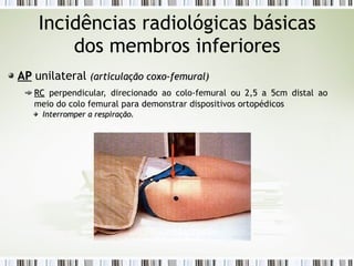 Incidências radiológicas básicas
dos membros inferiores
AP
AP unilateral (articulação coxo-femural)
(articulação coxo-femural)
RC
RC perpendicular, direcionado ao colo-femural ou 2,5 a 5cm distal ao
meio do colo femural para demonstrar dispositivos ortopédicos
Interromper a respiração.
Interromper a respiração.
 