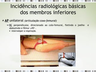Incidências radiológicas básicas
dos membros inferiores
AP
AP unilateral (articulação coxo-femural)
(articulação coxo-femural)
RC
RC perpendicular, direcionado ao colo-femural, fletindo o joelho e
abduzindo o fêmur ±45o
.
Interromper a respiração.
Interromper a respiração.
 