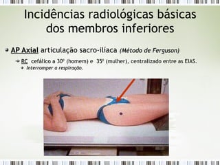 Incidências radiológicas básicas
dos membros inferiores
AP Axial
AP Axial articulação sacro-ilíaca (Método de Ferguson)
(Método de Ferguson)
RC
RC cefálico a
cefálico a 300
(homem) e 35
350
(mulher), centralizado entre as EIAS.
Interromper a respiração.
Interromper a respiração.
 