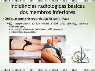 Incidências radiológicas básicas
dos membros inferiores
Oblíquas posteriores
Oblíquas posteriores articulação sacro-ilíaca
RC
RC perpendicular
perpendicular ±
±2,5cm medial a EIAS (lado elevado)
2,5cm medial a EIAS (lado elevado), paciente
inclinado ±30
±30o
o
.
Articulação visualizada: OPE – direita, OPD - esquerda
Articulação visualizada: OPE – direita, OPD - esquerda
Interromper a respiração.
Interromper a respiração.
 