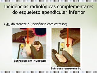 Incidências radiológicas complementares
do esqueleto apendicular inferior
AP
AP do tornozelo (incidência com estresse)
do tornozelo (incidência com estresse)
 