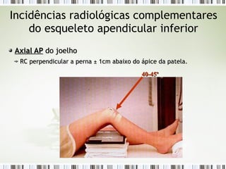Incidências radiológicas complementares
do esqueleto apendicular inferior
Axial AP
Axial AP do joelho
do joelho
RC perpendicular a perna
RC perpendicular a perna ±
± 1cm abaixo do ápice da patela.
1cm abaixo do ápice da patela.
40-45º
40-45º
 