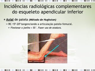 Incidências radiológicas complementares
do esqueleto apendicular inferior
Axial
Axial de patela
de patela (Método de
(Método de Hughston
Hughston)
)
RC
RC 150
-200
tangenciando a articulação patelo-femural.
Flexionar o joelho
Flexionar o joelho ≈
≈ 55°. Fazer uso de atadura.
55°. Fazer uso de atadura.
 