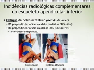 Incidências radiológicas complementares
do esqueleto apendicular inferior
Oblíqua
Oblíqua da pelve-acetábulo
da pelve-acetábulo (Método de
(Método de Judet
Judet)
)
RC
RC perpendicular a 5cm caudal e medial
perpendicular a 5cm caudal e medial as EIAS (Alar).
RC perpendicular a 5cm caudal
RC perpendicular a 5cm caudal as EIAS (Obturatriz).
Interromper a respiração.
Interromper a respiração.
Incidência Alar Incidência Obturatriz
 