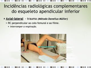 Incidências radiológicas complementares
do esqueleto apendicular inferior
Axial-lateral
Axial-lateral - trauma
- trauma (Método Danelius-Müller)
(Método Danelius-Müller)
RC
RC perpendicular ao colo femural e ao filme
perpendicular ao colo femural e ao filme.
Interromper a respiração.
Interromper a respiração.
 