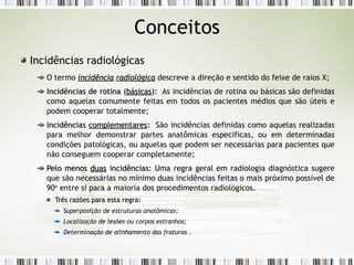 Conceitos
Incidências radiológicas
O termo incidência
incidência radiológica
radiológica descreve a direção e sentido do feixe de raios X;
Incidências de rotina (
Incidências de rotina (básicas
básicas):
): As incidências de rotina ou básicas são definidas
como aquelas comumente feitas em todos os pacientes médios que são úteis e
podem cooperar totalmente;
Incidências
Incidências complementares
complementares:
: São incidências definidas como aquelas realizadas
para melhor demonstrar partes anatômicas específicas, ou em determinadas
condições patológicas, ou aquelas que podem ser necessárias para pacientes que
não conseguem cooperar completamente;
Pelo menos
Pelo menos duas
duas incidências:
incidências: Uma regra geral em radiologia diagnóstica sugere
que são necessárias no mínimo duas incidências feitas o mais próximo possível de
90o
entre si para a maioria dos procedimentos radiológicos.
Três razões
Três razões para esta regra:
para esta regra:
Superposição de estruturas anatômicas;
Localização de lesões ou corpos estranhos;
Determinação de alinhamento das fraturas .
 