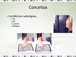 Conceitos
Incidências radiológicas
PA
AP
Lateral
Oblíqua
 