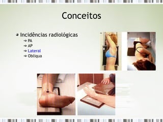 Conceitos
Incidências radiológicas
PA
AP
Lateral
Oblíqua
 