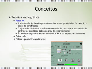 Conceitos
Técnica radiográfica
Fator kV
A alta-tensão (quilovoltagem) determina a energia do feixe de raios X, o
poder de penetração;
O ajuste de kV é fator primário de controle de contraste e secundário de
controle de densidade óptica ou grau de enegrecimento;
É calculado segundo a expressão impírica: kV = 2 x espessura + constante
Fator mAs
Fatores geométricos do feixe
 