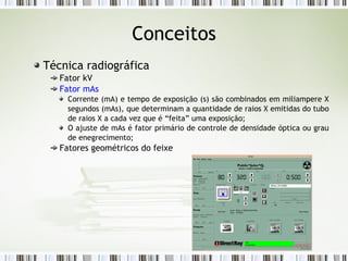 Conceitos
Técnica radiográfica
Fator kV
Fator mAs
Corrente (mA) e tempo de exposição (s) são combinados em miliampere X
segundos (mAs), que determinam a quantidade de raios X emitidas do tubo
de raios X a cada vez que é “feita” uma exposição;
O ajuste de mAs é fator primário de controle de densidade óptica ou grau
de enegrecimento;
Fatores geométricos do feixe
 