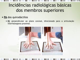 Incidências radiológicas básicas
dos membros superiores
PA
PA dos quirodáctilos
RC
RC perpendicular ao plano coronal, direcionado para a articulação
interfalangiana proximal.
 