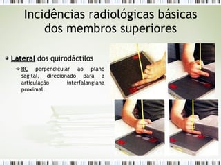 Incidências radiológicas básicas
dos membros superiores
Lateral
Lateral dos quirodáctilos
RC
RC perpendicular ao plano
sagital, direcionado para a
articulação interfalangiana
proximal.
 