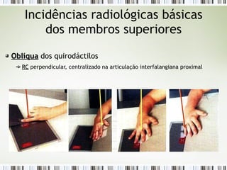 Incidências radiológicas básicas
dos membros superiores
Oblíqua
Oblíqua dos quirodáctilos
RC
RC perpendicular, centralizado na articulação interfalangiana proximal
 