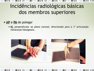 Incidências radiológicas básicas
dos membros superiores
AP
AP e
e PA
PA do polegar
RC
RC perpendicular ao plano coronal, direcionado para a 1º articulação
metacarpo falangeana.
 