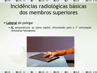 Incidências radiológicas básicas
dos membros superiores
Lateral
Lateral do polegar
RC
RC perpendicular ao plano sagital, direcionado para a 1º articulação
metacarpo falangeana.
 