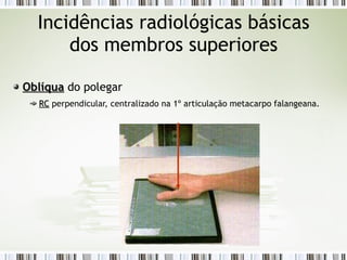 Incidências radiológicas básicas
dos membros superiores
Oblíqua
Oblíqua do polegar
RC
RC perpendicular, centralizado na 1º articulação metacarpo falangeana.
 