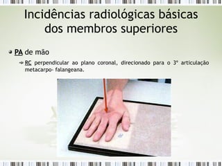 Incidências radiológicas básicas
dos membros superiores
PA
PA de mão
RC
RC perpendicular ao plano coronal, direcionado para o 3º articulação
metacarpo- falangeana.
 