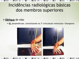 Incidências radiológicas básicas
dos membros superiores
Oblíqua
Oblíqua de mão
RC
RC perpendicular, centralizando na 3º articulação metacarpo- falangeana
45º
 