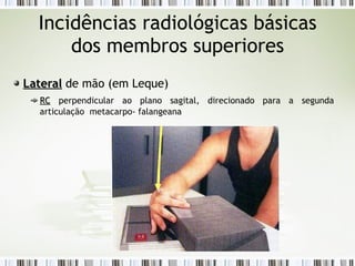 Incidências radiológicas básicas
dos membros superiores
Lateral
Lateral de mão (em Leque)
RC
RC perpendicular ao plano sagital, direcionado para a segunda
articulação metacarpo- falangeana
 