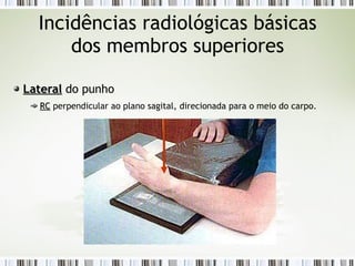 Incidências radiológicas básicas
dos membros superiores
Lateral
Lateral do punho
RC
RC perpendicular ao plano sagital, direcionada para o meio do carpo.
 