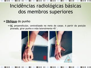 Incidências radiológicas básicas
dos membros superiores
Oblíqua
Oblíqua do punho
RC
RC perpendicular, centralizado no meio do carpo. A partir da posição
pronada, girar punho e mão lateralmente 45°.
45
º
 
