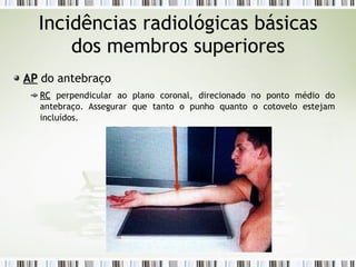 Incidências radiológicas básicas
dos membros superiores
AP
AP do antebraço
RC
RC perpendicular ao plano coronal, direcionado no ponto médio do
antebraço. Assegurar que tanto o punho quanto o cotovelo estejam
incluídos.
 