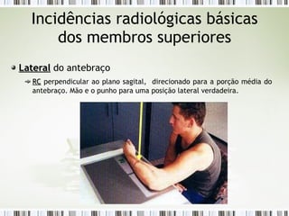 Incidências radiológicas básicas
dos membros superiores
Lateral
Lateral do antebraço
RC
RC perpendicular ao plano sagital, direcionado para a porção média do
antebraço. Mão e o punho para uma posição lateral verdadeira.
 