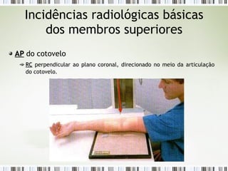 Incidências radiológicas básicas
dos membros superiores
AP
AP do cotovelo
RC
RC perpendicular ao plano coronal, direcionado no meio da articulação
do cotovelo.
 