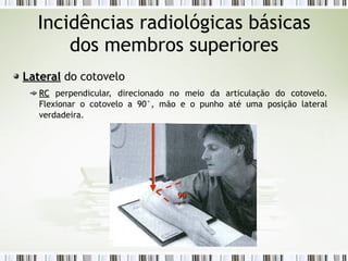 Incidências radiológicas básicas
dos membros superiores
Lateral
Lateral do cotovelo
RC
RC perpendicular, direcionado no meio da articulação do cotovelo.
Flexionar o cotovelo a 90°, mão e o punho até uma posição lateral
verdadeira.
90
90
º
º
 