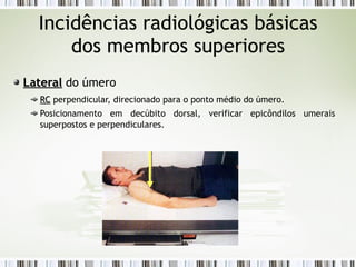 Incidências radiológicas básicas
dos membros superiores
Lateral
Lateral do úmero
RC
RC perpendicular, direcionado para o ponto médio do úmero.
Posicionamento em decúbito dorsal, verificar epicôndilos umerais
superpostos e perpendiculares.
 