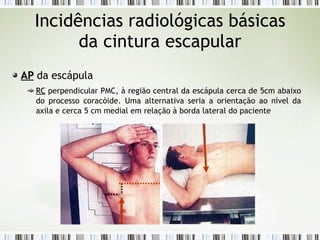Incidências radiológicas básicas
da cintura escapular
AP
AP da escápula
RC
RC perpendicular PMC, à região central da escápula cerca de 5cm abaixo
do processo coracóide. Uma alternativa seria a orientação ao nível da
axila e cerca 5 cm medial em relação à borda lateral do paciente
 