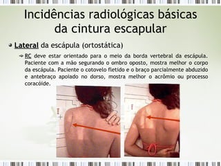 Incidências radiológicas básicas
da cintura escapular
Lateral
Lateral da escápula (ortostática)
RC
RC deve estar orientado para o meio da borda vertebral da escápula.
Paciente com a mão segurando o ombro oposto, mostra melhor o corpo
da escápula. Paciente o cotovelo fletido e o braço parcialmente abduzido
e antebraço apoiado no dorso, mostra melhor o acrômio ou processo
coracóide.
 
