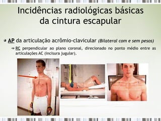 Incidências radiológicas básicas
da cintura escapular
AP
AP da articulação acrômio-clavicular (Bilateral com e sem pesos)
(Bilateral com e sem pesos)
RC
RC perpendicular ao plano coronal, direcionado no ponto médio entre as
articulações AC (incisura jugular).
 