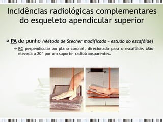 Incidências radiológicas complementares
do esqueleto apendicular superior
PA
PA de punho (Método de Stecher modificado
(Método de Stecher modificado – estudo do escafóide
– estudo do escafóide)
)
RC
RC perpendicular ao plano coronal, direcionado para o escafóide. Mão
elevada a 20° por um suporte radiotransparentes.
20º
 