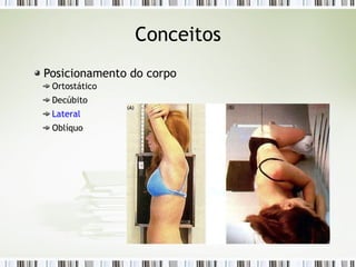 Conceitos
Posicionamento do corpo
Ortostático
Decúbito
Lateral
Oblíquo
 