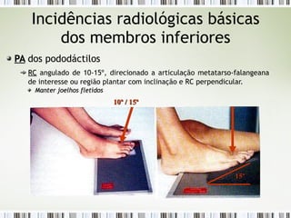 Incidências radiológicas básicas
dos membros inferiores
PA
PA dos pododáctilos
RC
RC angulado de 10-15º, direcionado a articulação metatarso-falangeana
de interesse ou região plantar com inclinação e RC perpendicular.
Manter joelhos fletidos
Manter joelhos fletidos
10º / 15º
10º / 15º
15º
15º
 