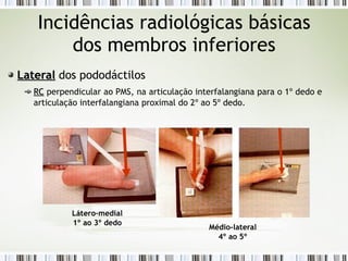 Incidências radiológicas básicas
dos membros inferiores
Lateral
Lateral dos pododáctilos
RC
RC perpendicular ao PMS, na articulação interfalangiana para o 1º dedo e
articulação interfalangiana proximal do 2º ao 5º dedo.
Látero–medial
1º ao 3º dedo
Médio-lateral
4º ao 5º
 