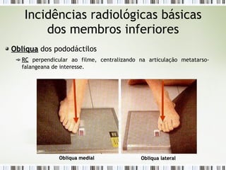 Incidências radiológicas básicas
dos membros inferiores
Oblíqua
Oblíqua dos pododáctilos
RC
RC perpendicular ao filme, centralizando na articulação metatarso-
falangeana de interesse.
Oblíqua medial
Oblíqua medial Oblíqua lateral
Oblíqua lateral
 