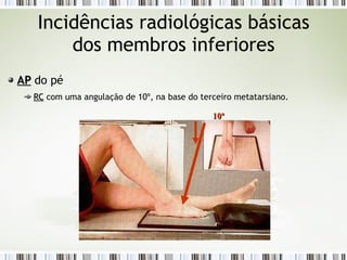 Incidências radiológicas básicas
dos membros inferiores
AP
AP do pé
RC
RC com uma angulação de 10º, na base do terceiro metatarsiano.
10º
10º
 