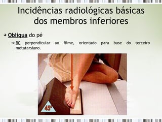 Incidências radiológicas básicas
dos membros inferiores
Oblíqua
Oblíqua do pé
RC
RC perpendicular ao filme, orientado para base do terceiro
metatarsiano.
45º
 