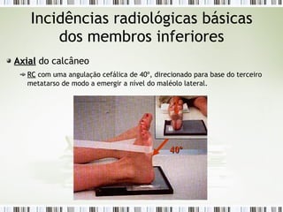 Incidências radiológicas básicas
dos membros inferiores
Axial
Axial do calcâneo
RC
RC com uma angulação cefálica de 40º, direcionado para base do terceiro
metatarso de modo a emergir a nível do maléolo lateral.
40º
40º
 
