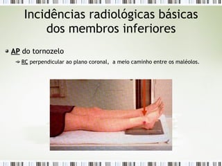 Incidências radiológicas básicas
dos membros inferiores
AP
AP do tornozelo
RC
RC perpendicular ao plano coronal, a meio caminho entre os maléolos.
 