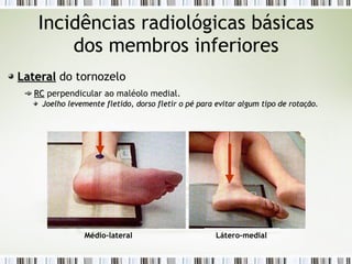 Incidências radiológicas básicas
dos membros inferiores
Lateral
Lateral do tornozelo
RC
RC perpendicular ao maléolo medial.
Joelho levemente fletido, dorso fletir o pé para evitar algum tipo de rotação.
Joelho levemente fletido, dorso fletir o pé para evitar algum tipo de rotação.
Médio-lateral Látero-medial
 