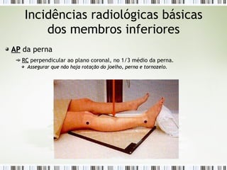 Incidências radiológicas básicas
dos membros inferiores
AP
AP da perna
RC
RC perpendicular ao plano coronal, no 1/3 médio da perna.
Assegurar que não haja rotação do joelho, perna e tornozelo.
Assegurar que não haja rotação do joelho, perna e tornozelo.
 