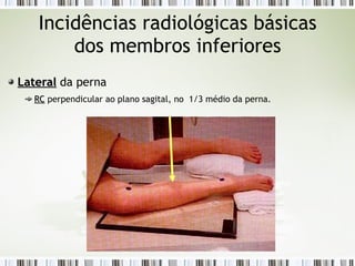 Incidências radiológicas básicas
dos membros inferiores
Lateral
Lateral da perna
RC
RC perpendicular ao plano sagital, no 1/3 médio da perna.
 