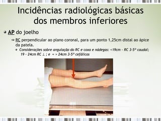 Incidências radiológicas básicas
dos membros inferiores
AP
AP do joelho
RC
RC perpendicular ao plano coronal, para um ponto 1,25cm distal ao ápice
da patela.
Considerações sobre angulação do RC e coxa e nádegas:
Considerações sobre angulação do RC e coxa e nádegas: <19cm - RC 3-5º caudal;
<19cm - RC 3-5º caudal;
19 - 24cm RC
19 - 24cm RC ⊥
⊥ ; e = > 24cm 3-5º cefálicos
; e = > 24cm 3-5º cefálicos
 