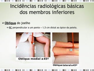 Incidências radiológicas básicas
dos membros inferiores
Oblíqua
Oblíqua do joelho
RC
RC perpendicular a um ponto ≈ 1,5 cm distal ao ápice da patela.
 
