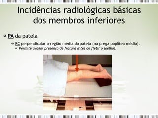 Incidências radiológicas básicas
dos membros inferiores
PA
PA da patela
RC
RC perpendicular a região média da patela (na prega poplítea média).
Permite avaliar presença de fratura antes de fletir o joelho).
Permite avaliar presença de fratura antes de fletir o joelho).
 